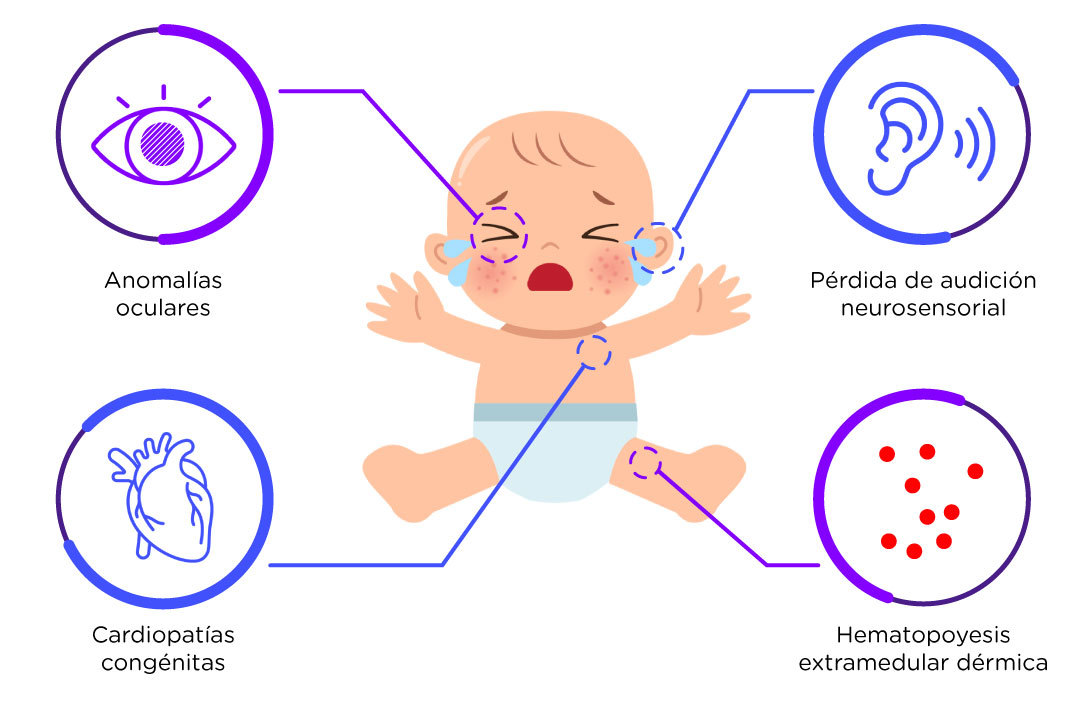 ToRCH ¿Qué significa, qué enfermedades incluye? ANNAR Health