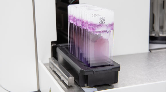 Atellica-hema-580-Siemens-Hematología-ANNAR-Imagen5
