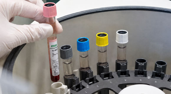 Diacent-CW-Biorad-Inmunohematología-ANNAR-Imagen5