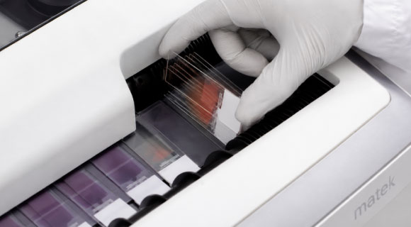 Hematek-3000-Siemens-Hematología-ANNAR-Imagen4