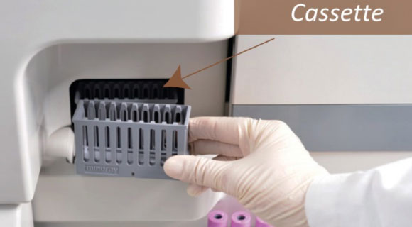 SC-120-Mindray-Hematología-ANNAR-Imagen4