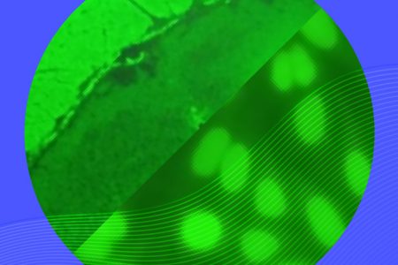 Aquí te contaremos lo más reciente que tienen publicado la Federación Europea de Química Clínica y Medicina de Laboratorio (EFLM) en conjunto con la Iniciativa Europea de Estandarización Autoinmune (EASI) y el Consenso Internacional sobre Patrones ANA (ICAP) acerca de este interesante campo de la lectura de IFI para las ANA- Asociadas a Enfermedades Reumáticas -AARD- (ANA-associated rheumatic diseases), para la Artritis idiopática Juvenil, la hepatitis autoinmune y la colangitis biliar primaria.